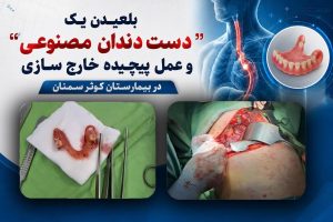 انجام موفق عملیات جراحی پیچیده بازکردن مری و خارج کردن دندان مصنوعی در بیمارستان کوثر سمنان