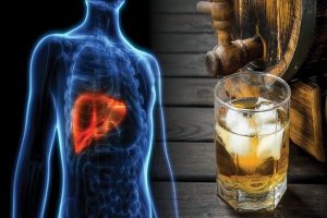 افزایش هشدارها در مورد ارتباط بین مصرف الکل و سرطان - خبرگزاری مهر | اخبار ایران و جهان