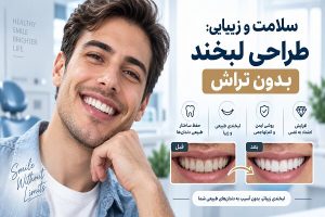 بازسازی لبخند پس از ازدست‌دادن دندان؛ از ایمپلنت تا طراحی لبخند - خبرگزاری مهر | اخبار ایران و جهان
