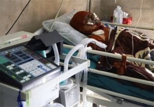 مرگ مشکوک مرد جوان روی تخت بخش سوختگی بیمارستان